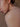 Hyperpigmentation- why is it caused and how to treat it? Vana Botanicals